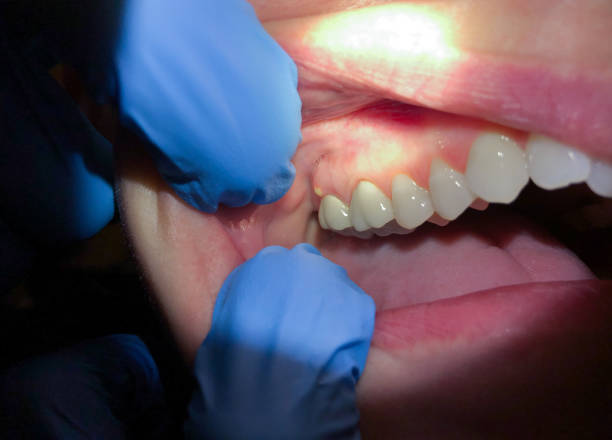 Best After-Hours Dental Trauma Care in Horse Pasture, VA