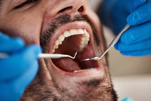 Best Emergency Tooth Extraction in Horse Pasture, VA
