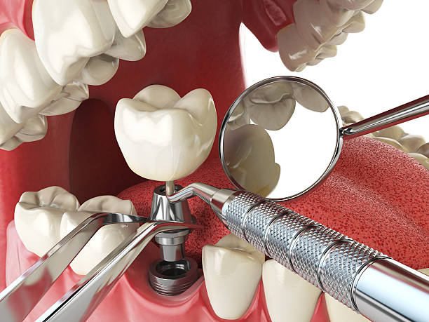 Best Same-Day Emergency Dental Services in Horse Pasture, VA