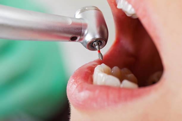Best 24-Hour Emergency Dentist in Horse Pasture, VA